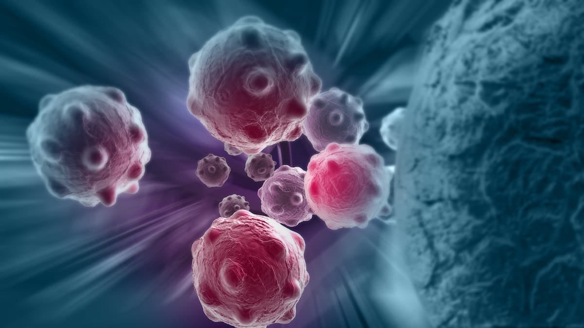 Updated Efficacy and Safety Data Continue to Support Zanubrutinib Use in Released/Refractory MCL