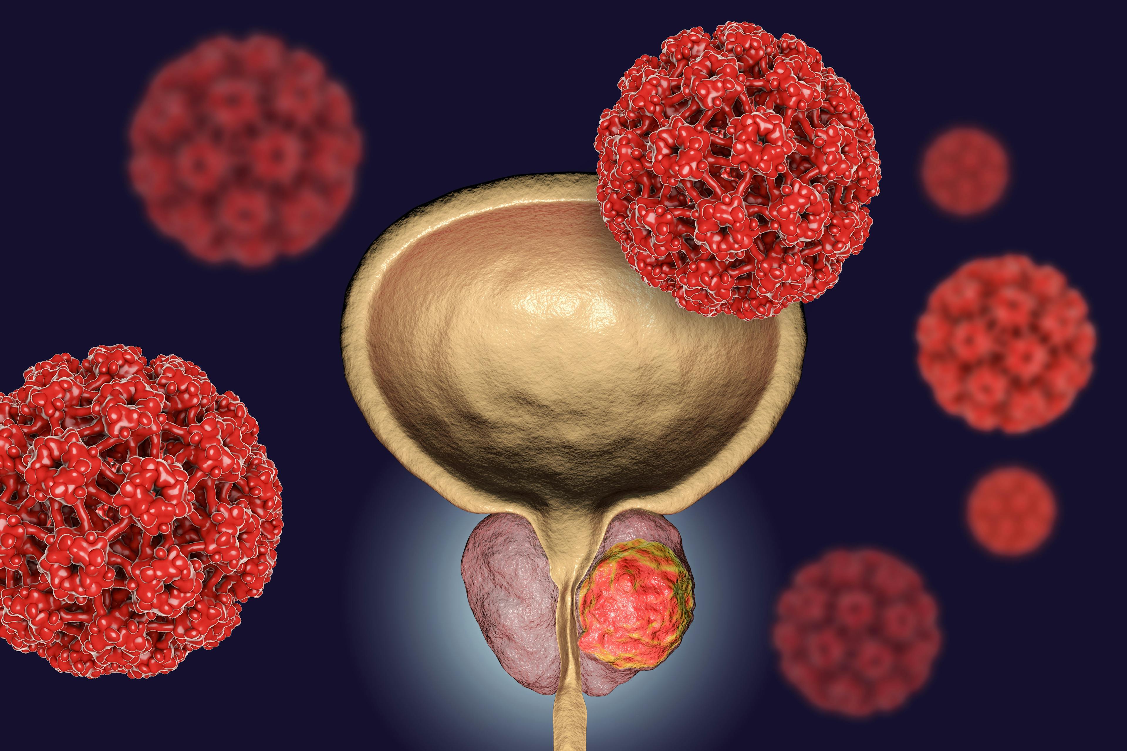 Preliminary findings indicate that P-PSMA-101, a CAR T-cell therapy, may be efficacious in patient with metastatic castration-resistant prostate cancer.