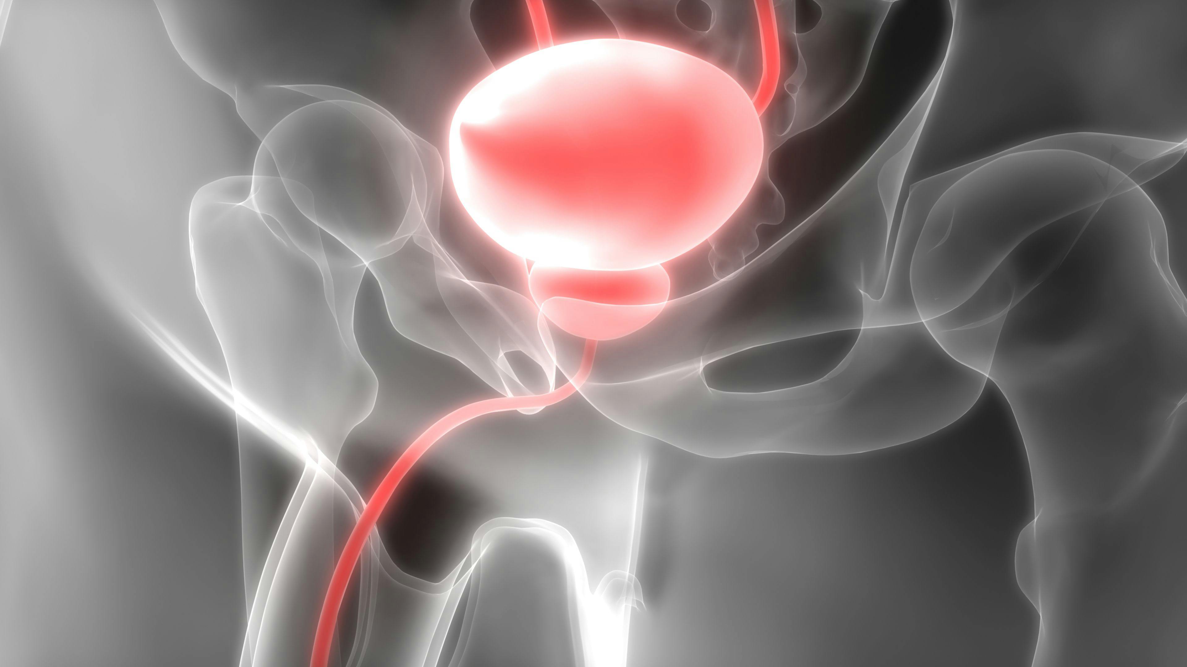 Patients with metastatic castration-resistant prostate cancer with or without homologous recombination repair gene mutations may derive benefit from olaparib and abiraterone acetate, according data from the phase 3 PROpel trial.
