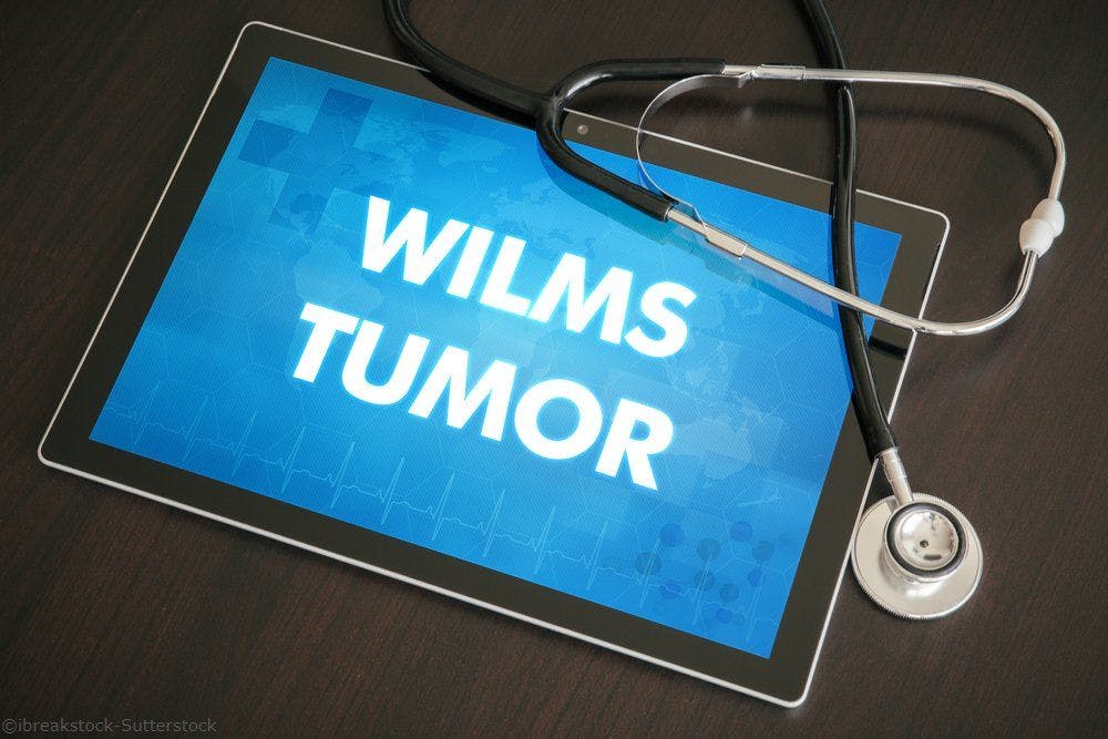 New Study Uncovers Underlying Mechanisms in Wilms Tumor