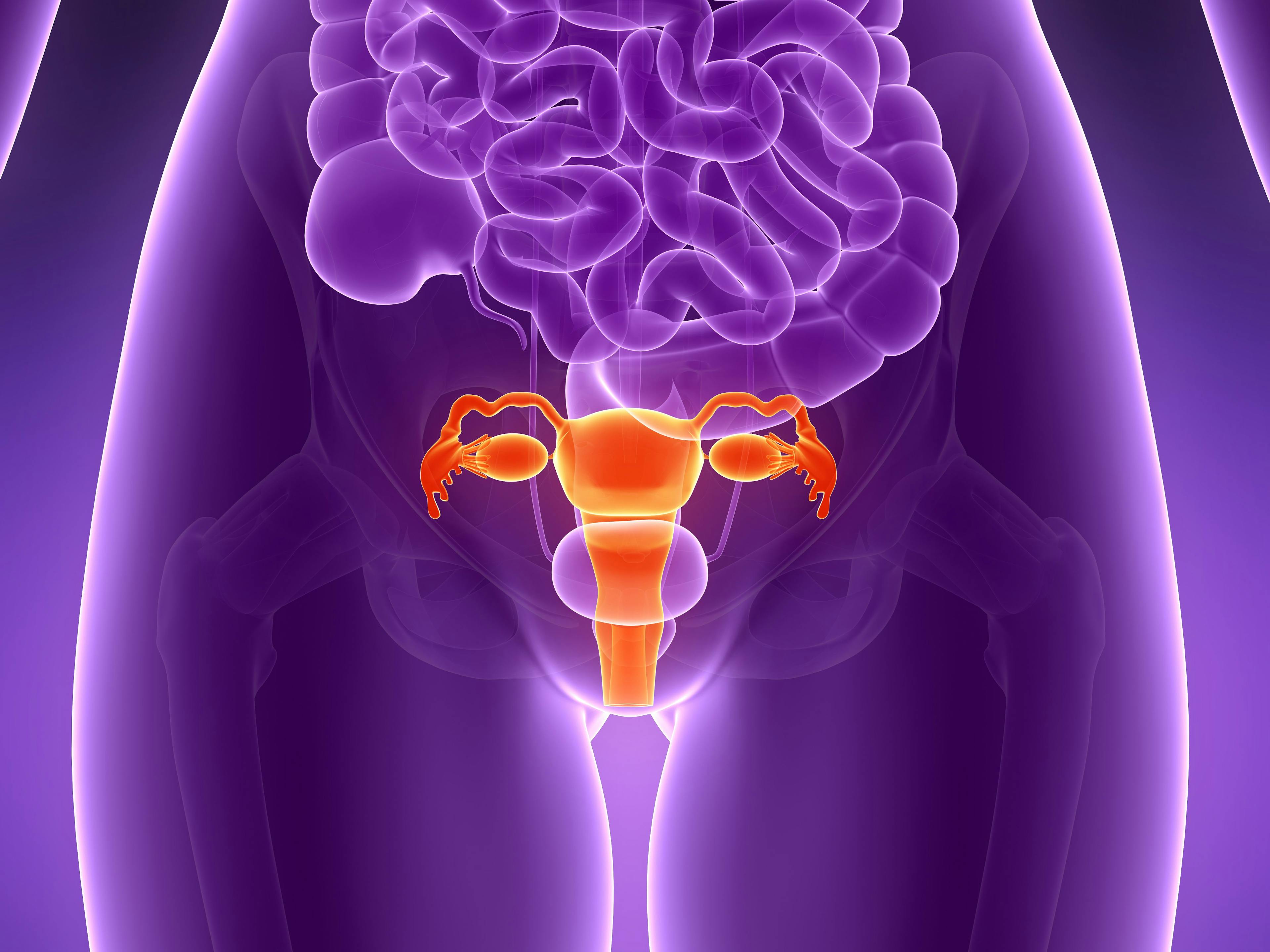 Financial Toxicity May Lead to Cost-Coping Strategies in Gynecologic Cancer