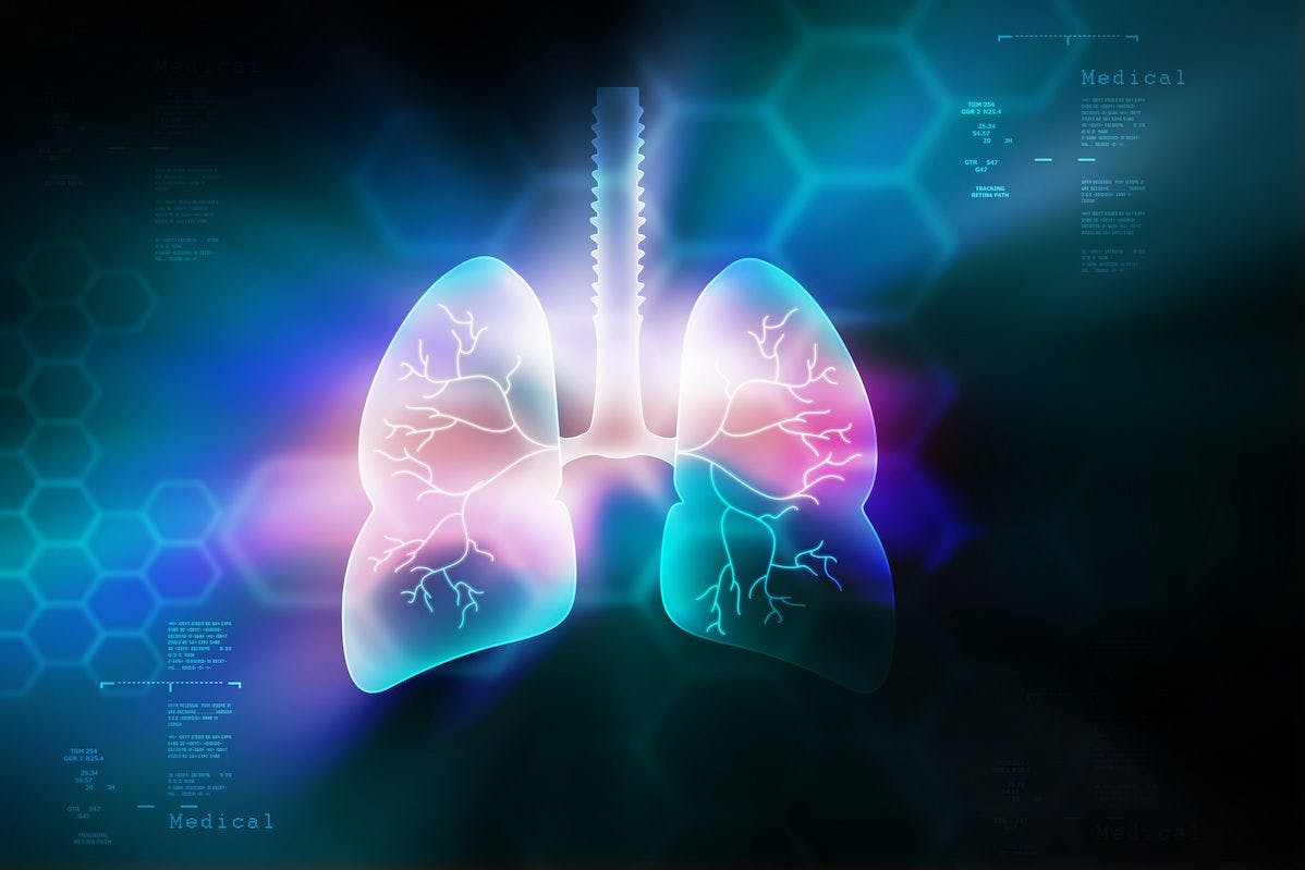 Data from the phase 2 NIPU trial support the FDA’s fast track designation for UV1 in combination with nivolumab and ipilimumab as a treatment for those with unresectable pleural malignant mesothelioma.