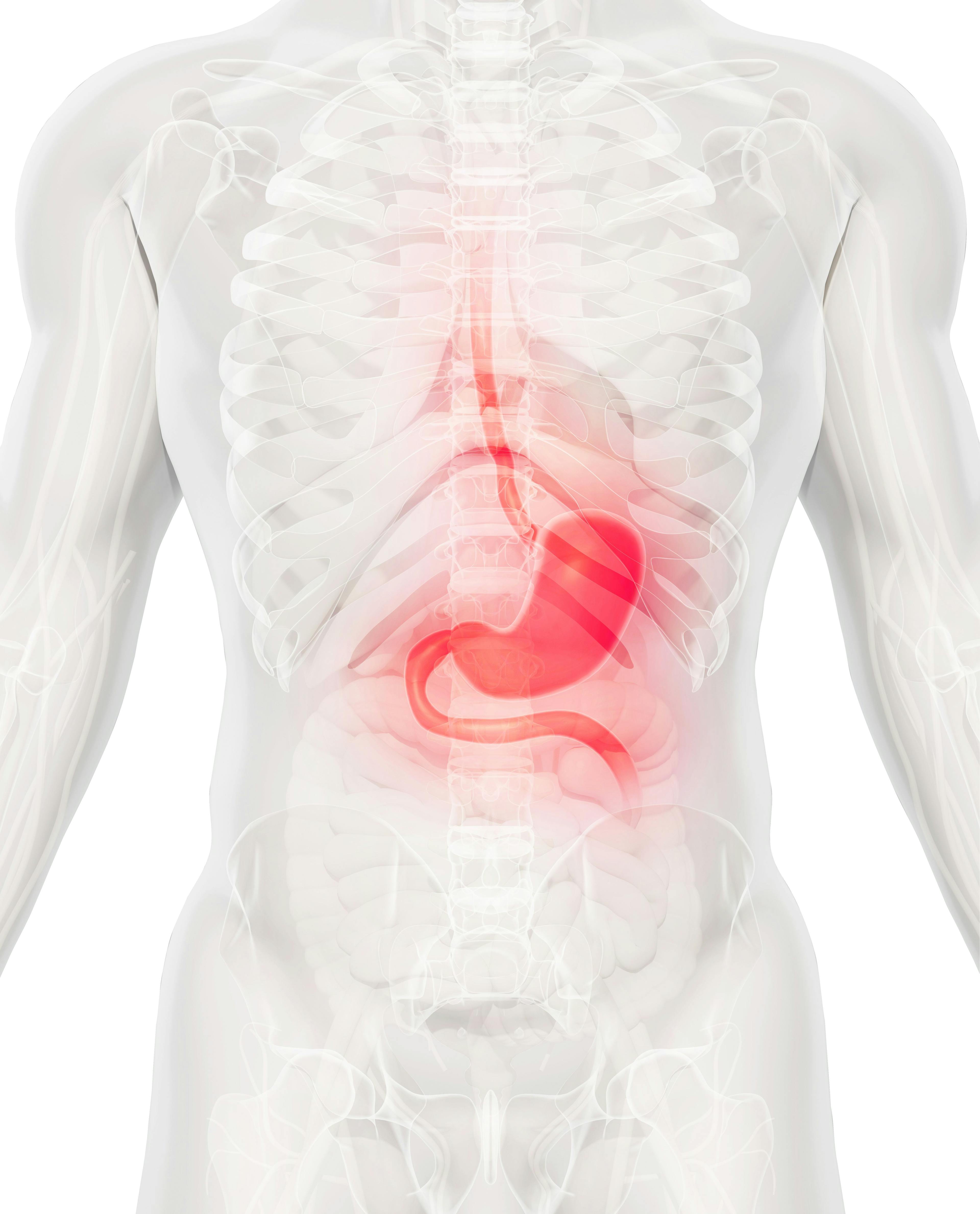 “Fruquintinib plus paclitaxel could be a promising second-line treatment option for patients with advanced gastric/GEJ adenocarcinoma who have [progressed on] fluoropyrimidine- or platinum-containing chemotherapy,” according to Rui-Hua Xu, MD, PhD.
