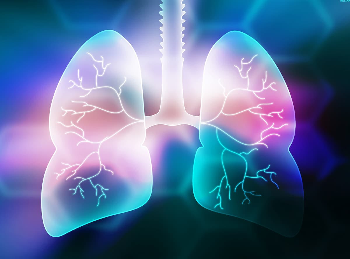 The FDA accepted a biologics license application for dato-DXd for patients with NSCLC in February 2024.