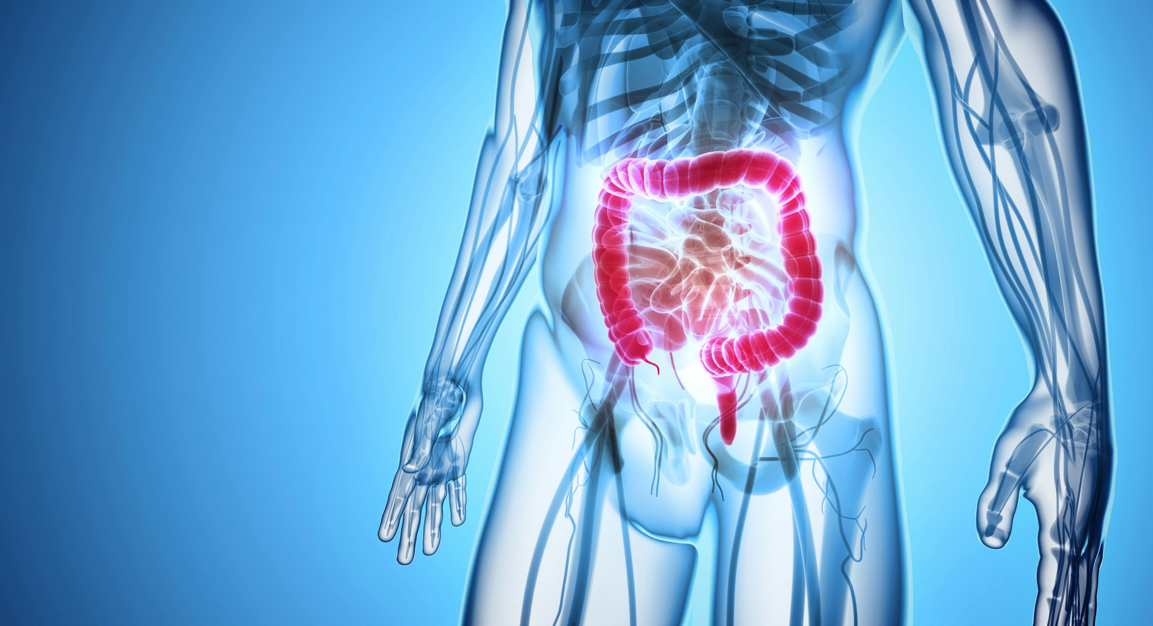 Results from a phase 1/2 study showed that a combination of encorafenib, cetuximab, and nivolumab was well tolerated and yielded promising responses in patients with microsatellite stable BRAFV600E metastatic colorectal cancer.