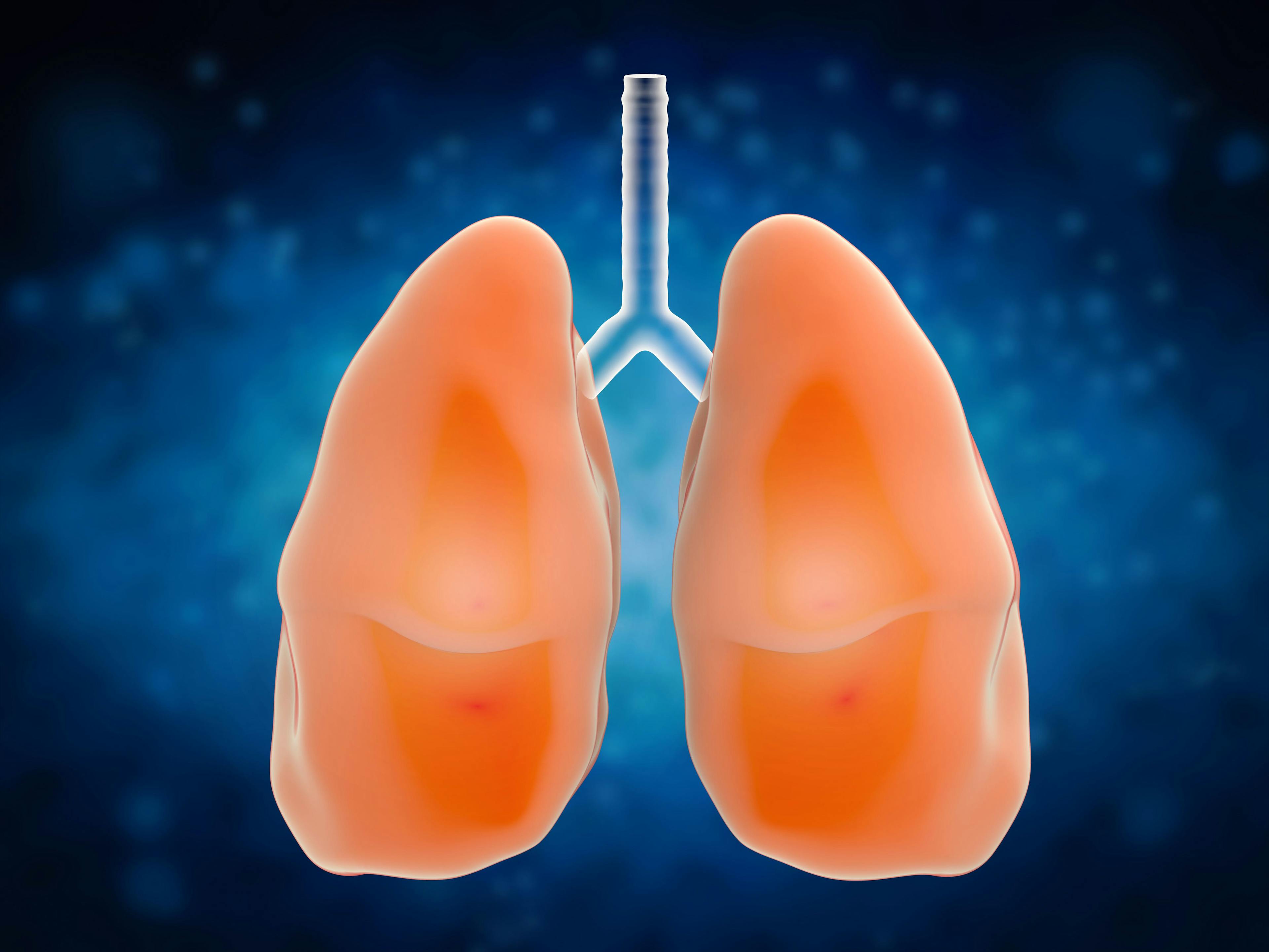 In March 2024, the FDA approved amivantamab-vmjw in combination with carboplatin and pemetrexed as frontline therapy for patients with locally advanced or metastatic non–small cell lung cancer harboring EGFR exon 20 insertion mutations.