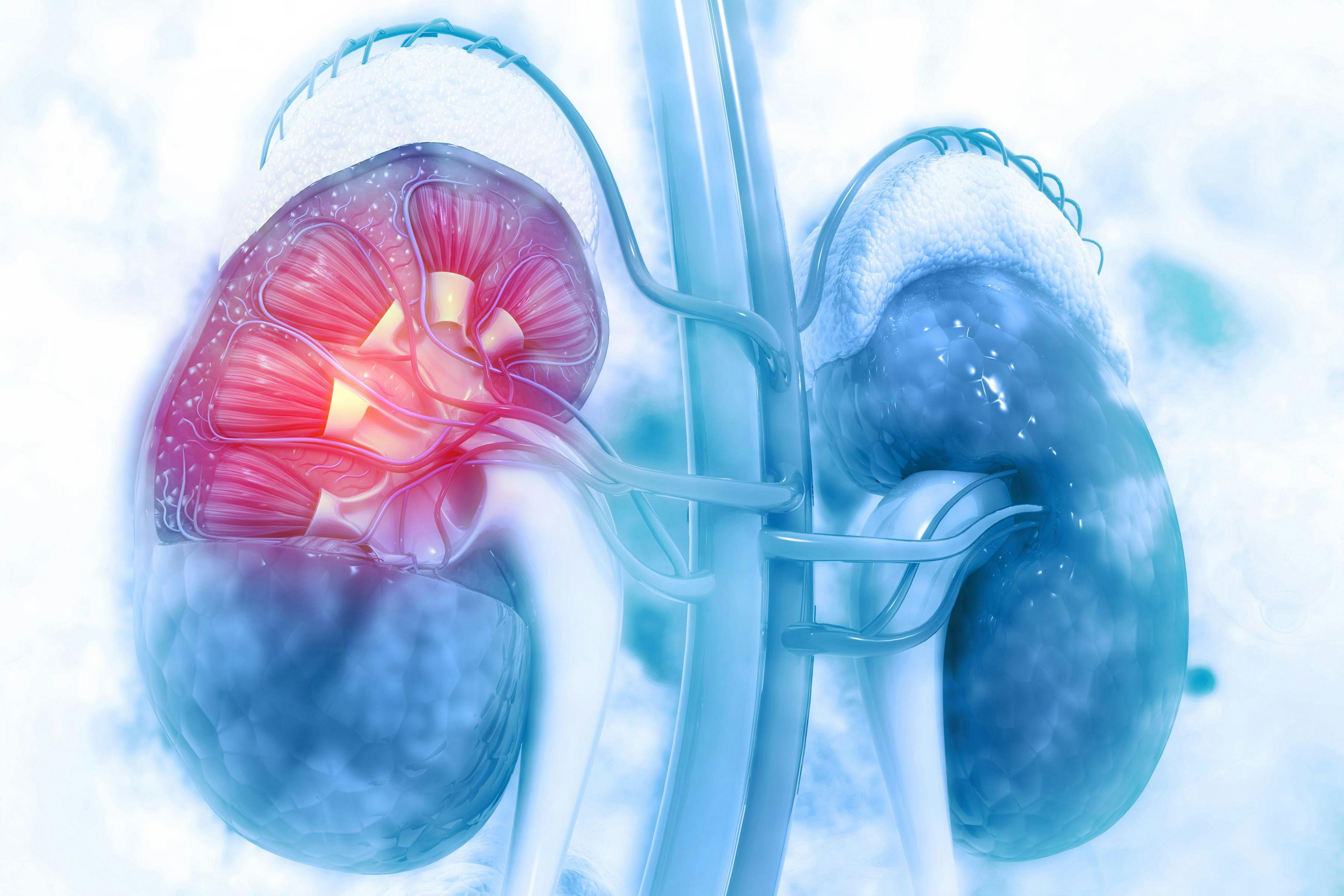 Patients with advanced renal cell carcinoma experienced improvements in both progression-free and overall survival after being treated with first-line immunotherapy vs sunitinib, although the benefit is yet to be determined in those with favorable-risk disease.