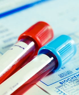 Blood-Based Screening Test May Aid in Detecting GI Cancers