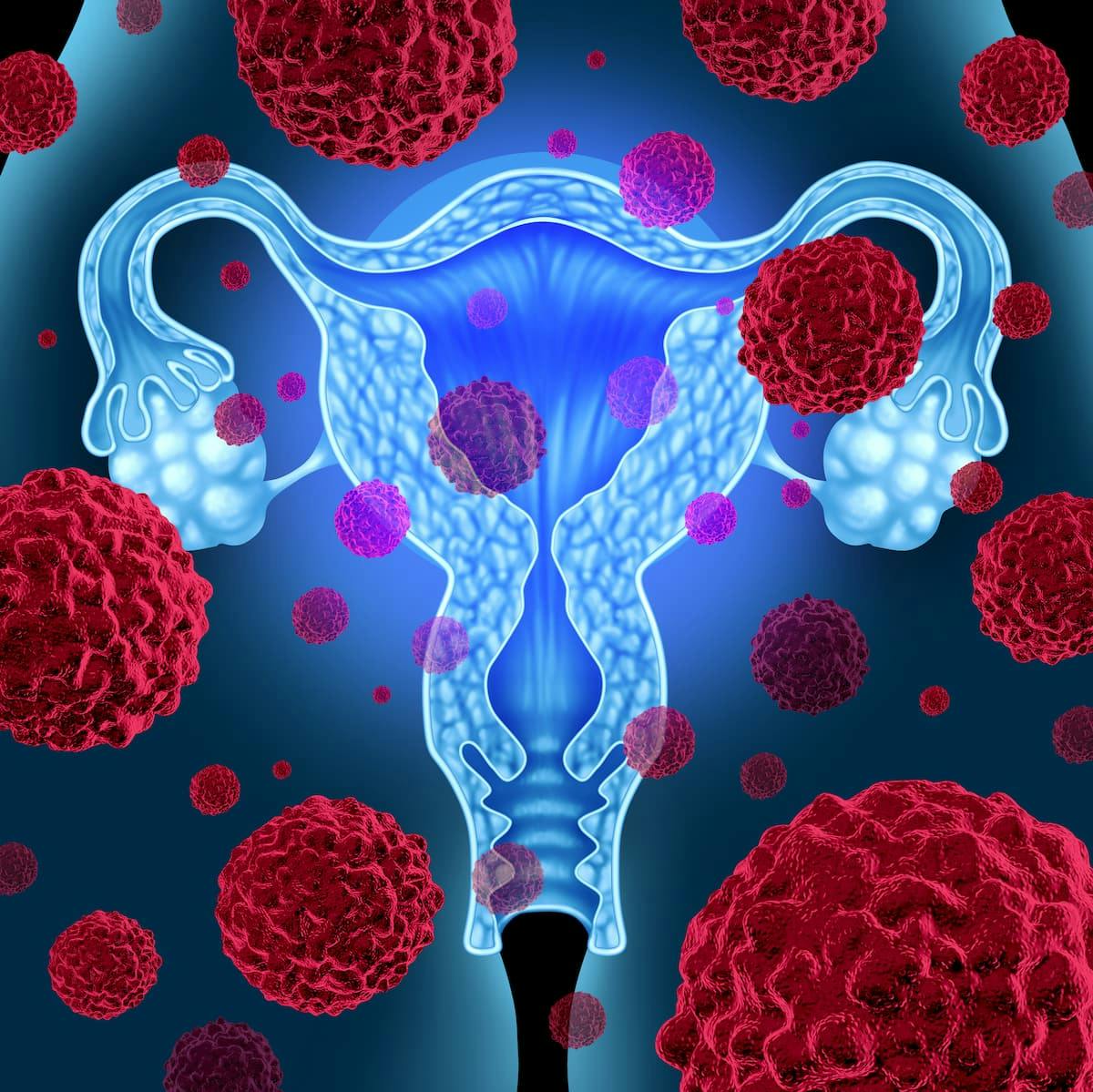 Dostarlimab Earns FDA Priority Review in All Advanced Endometrial Cancers | Image Credit: © freshidea - stock.adobe.com.
