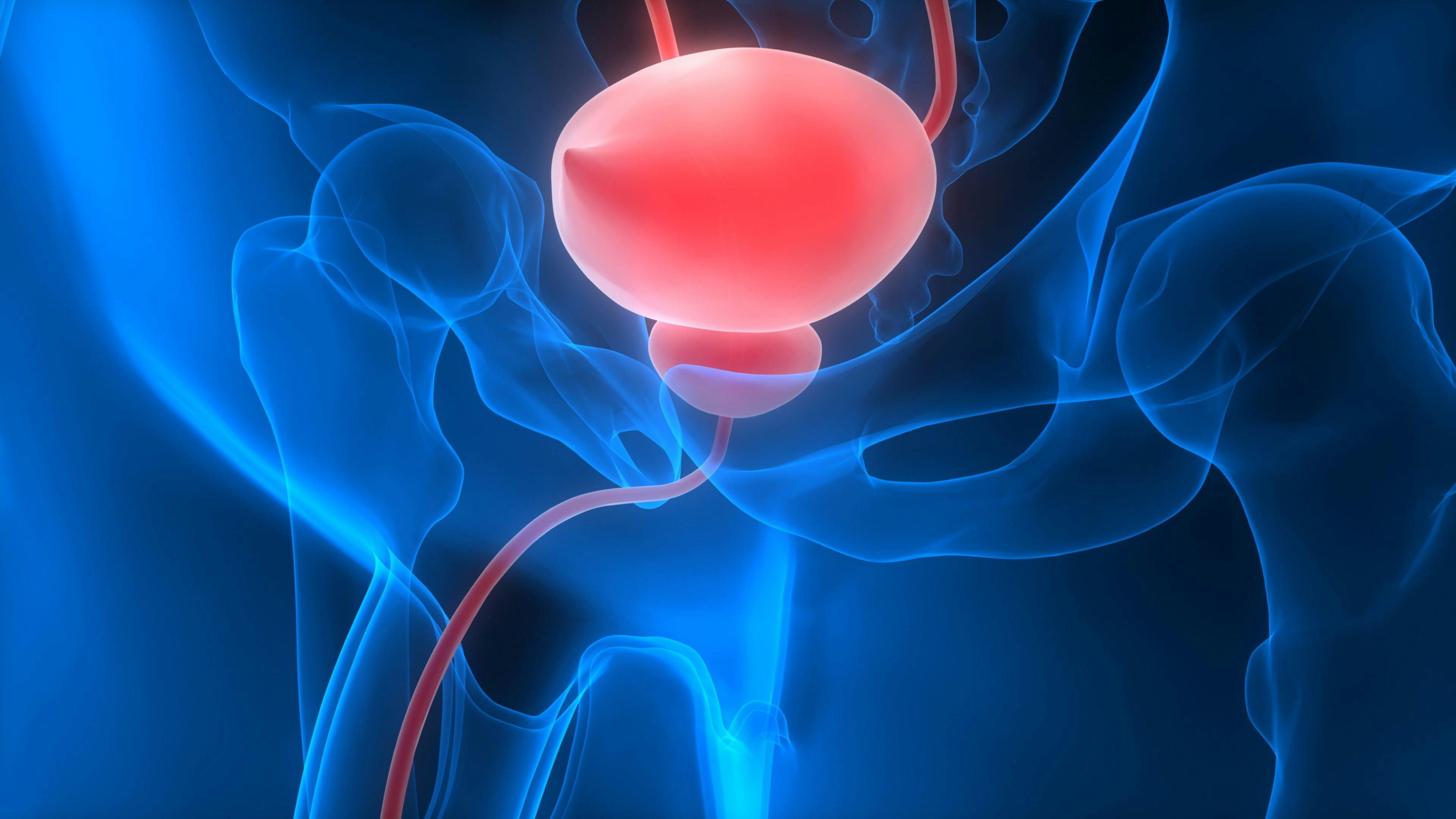 Enzalutamide monotherapy could be a promising alternative to active surveillance for patients with low- and intermediate-risk localized prostate cancer.
