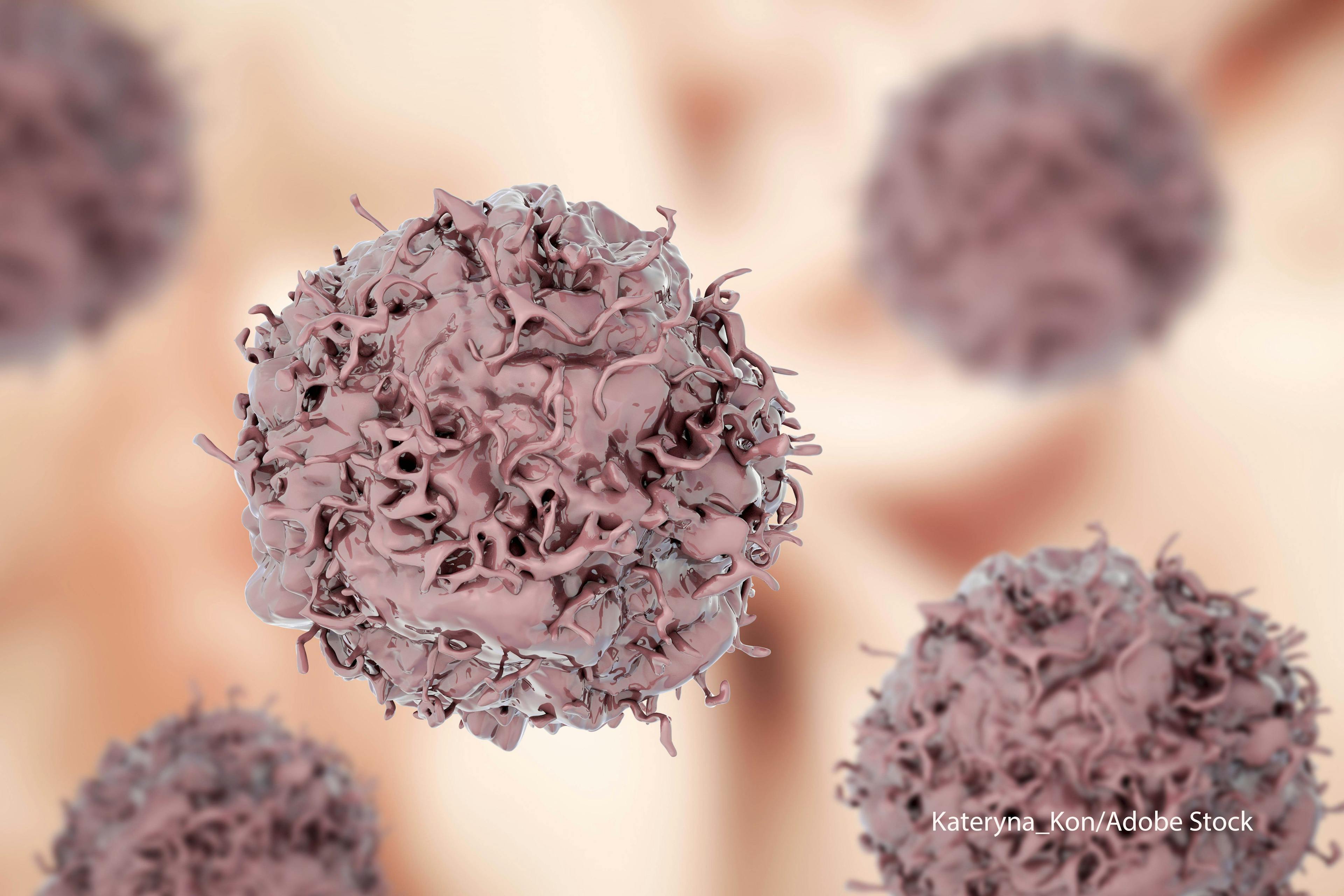 Immunotherapy Combinations Add Treatment Options in Advanced NSCLC