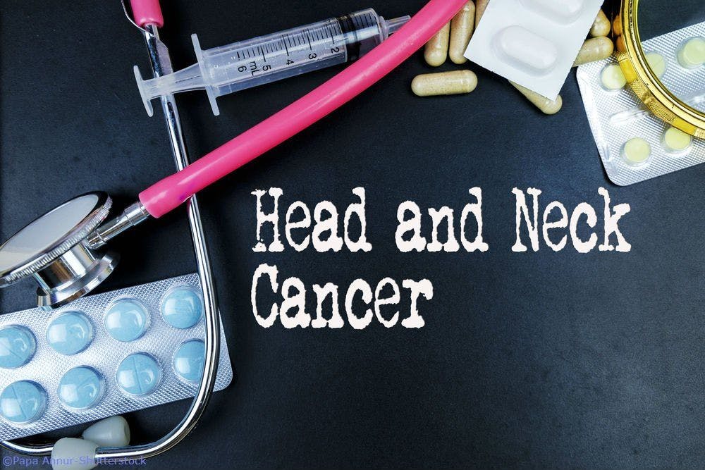 Late Stage Head and Neck Cancer in the U.S. Sees Increasing Incidence