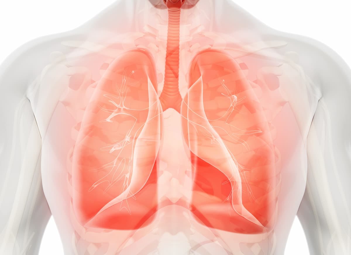 “Ensartinib represents a new first-line treatment option for patients with ALK-positive NSCLC,” according to the authors of the phase 3 eXalt3 trial (NCT02767804).