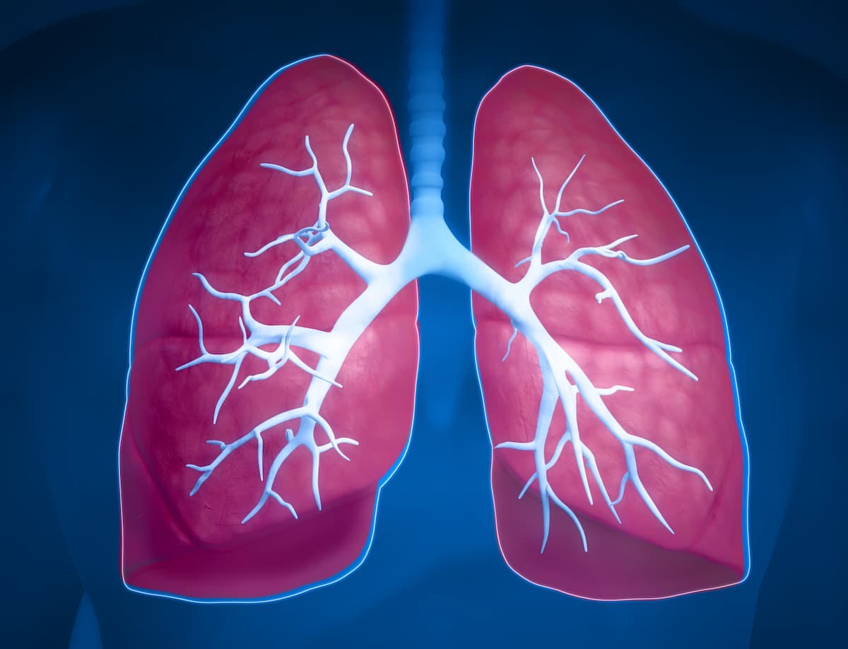 Data from the phase 3 MARIPOSA study support the Type II application for amivantamab plus lazertinib as a treatment for those with EGFR-mutated non–small cell lung cancer.